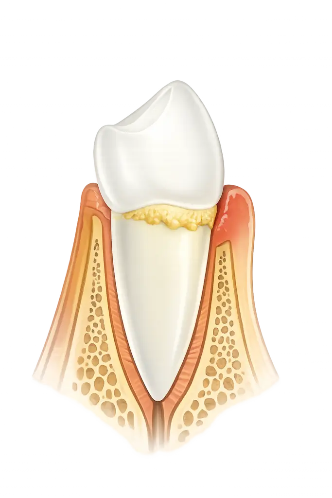Dentalhygiene Basel für saubere Zähne